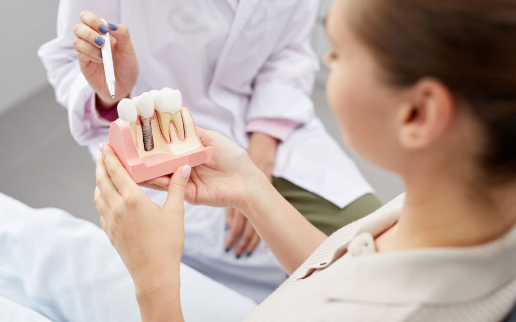 Dental Implants