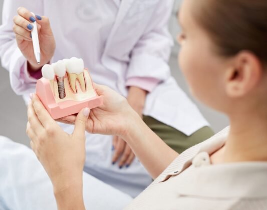 Dental Implants