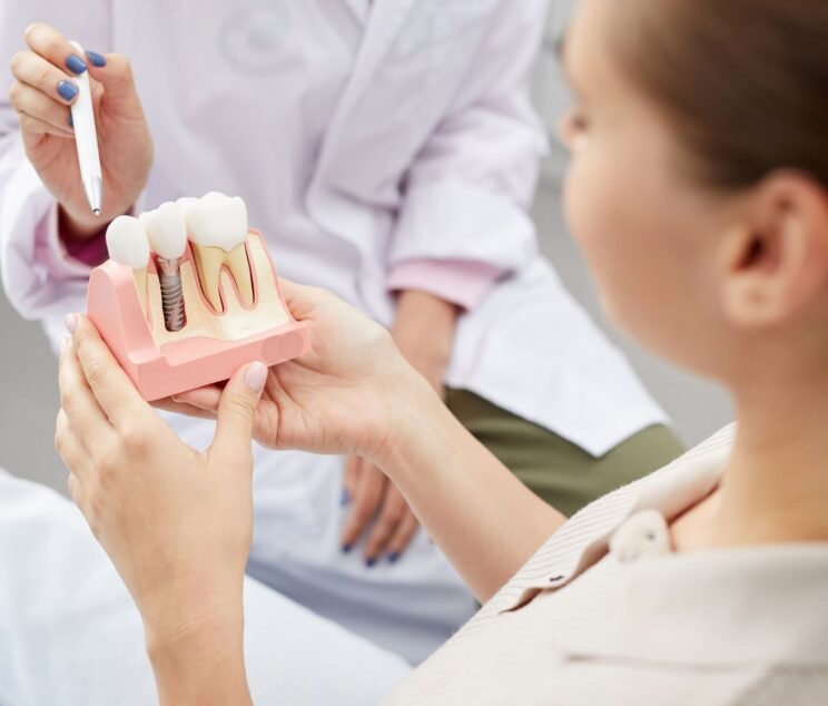 Dental Implants