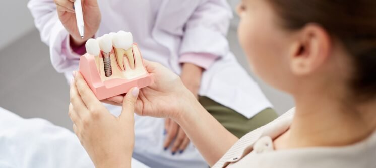 Dental Implants