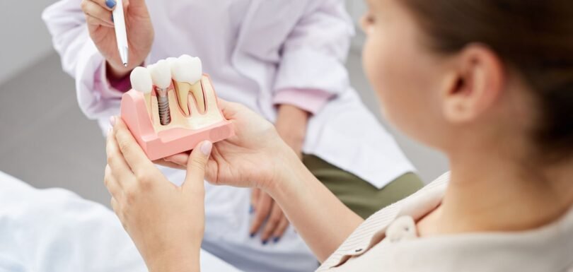 Dental Implants