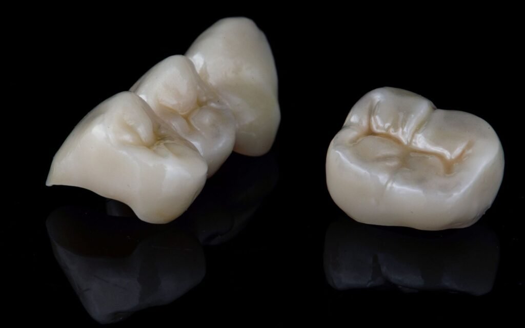 Zirconia Crown vs Ceramic Crown: Which Looks More Natural?