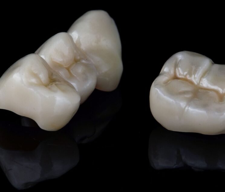 Zirconia Crown vs Ceramic Crown: Which Looks More Natural?