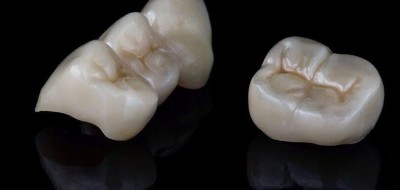 Zirconia Crown vs Ceramic Crown: Which Looks More Natural?
